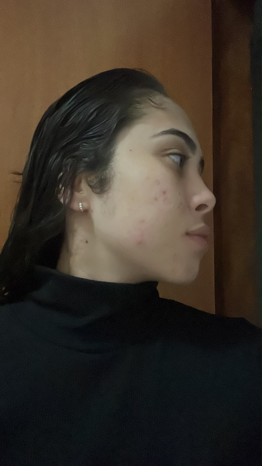 Pele depois do tratamento